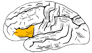 partie triangulaire du gyrus frontal inférieur